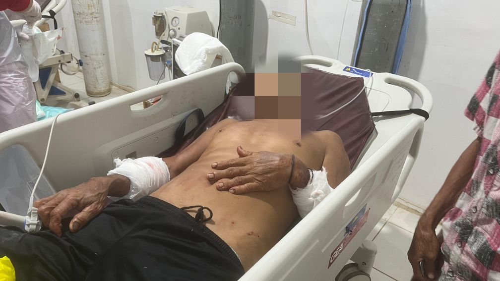 Warga Bataguh Jadi Korban Penganiayaan Dibacok Dengan Sajam